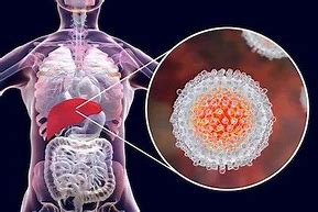 中药|身体上半身出现这4种变化,小心是肝脏癌变的信号!