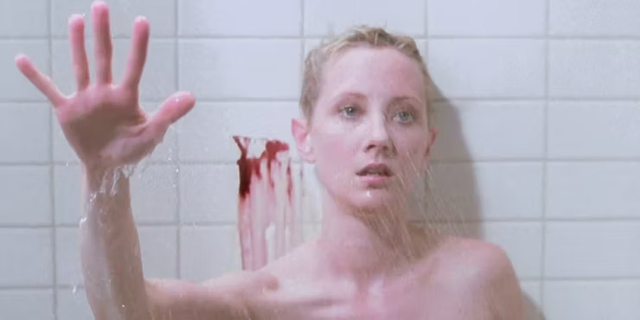 好莱坞|好莱坞女星遭车祸，全身严重烧伤生命垂危！