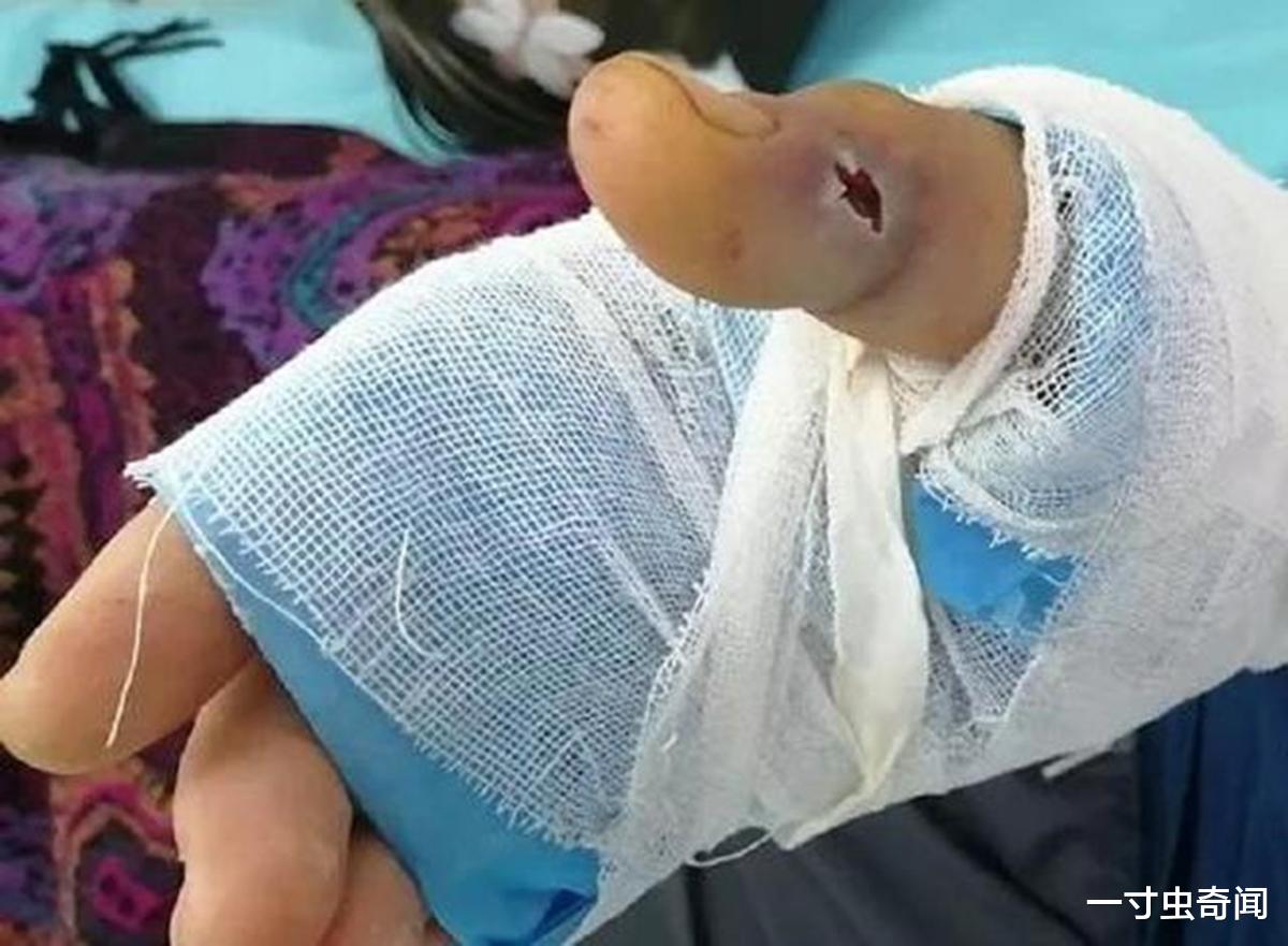 婴儿|毒蛇泡在酒中几年,为啥还能复活咬死人?蛇体内寄生虫能被泡死吗