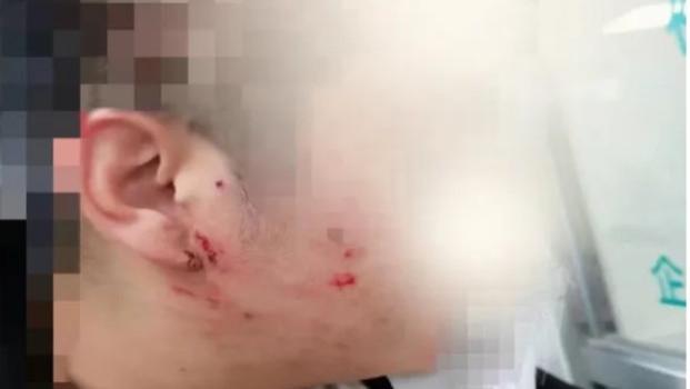 辽宁大连，男子为制止做核酸插队的一家4口，被对方父子2人按倒在地殴打