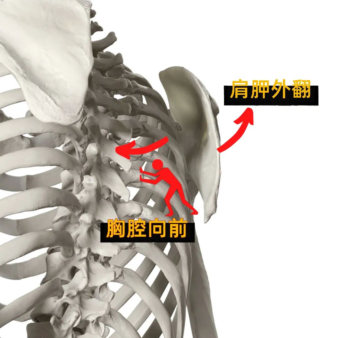胃病|翼状肩别只怪肩胛，它可能是无辜的！翼状肩这样矫正才有效