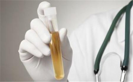 |男人晨起后“第一泡尿”,若有这3种共性,偷乐吧,肾脏还很好!