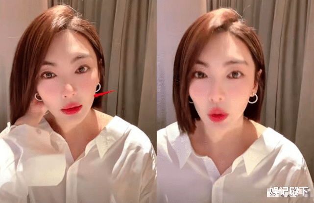张雨绮|张雨绮整容大变样,尖下巴能戳人漂唇像张含韵,整张脸满是塑料感