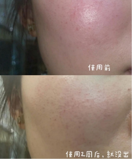 云朵 敏感肌如何彻底修复好