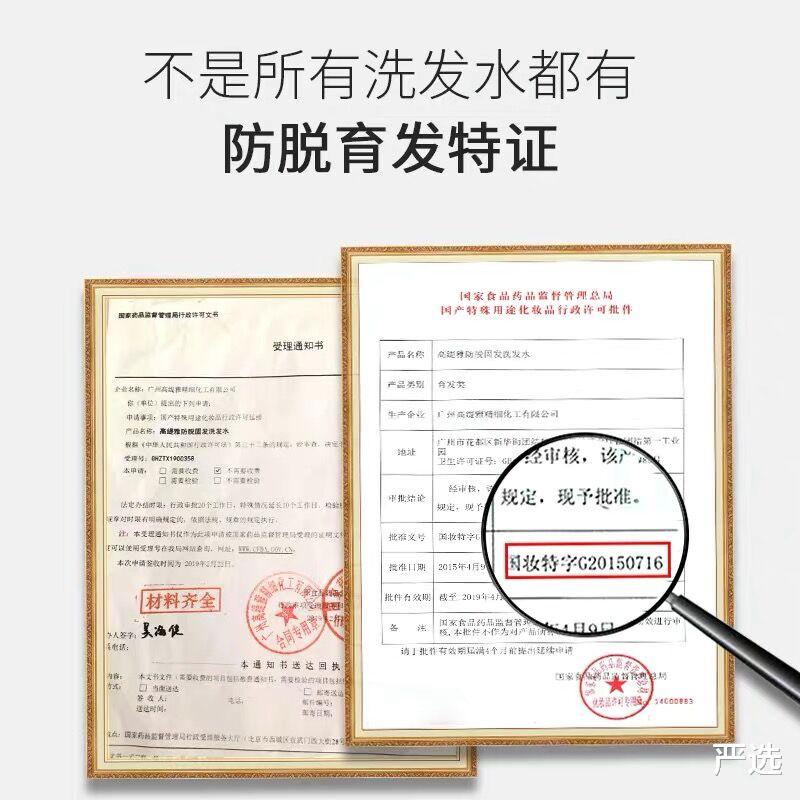 洗发水 曝光：这3种“洗发水”已经被列入黑名单，还有很多人在用，难怪会脱发