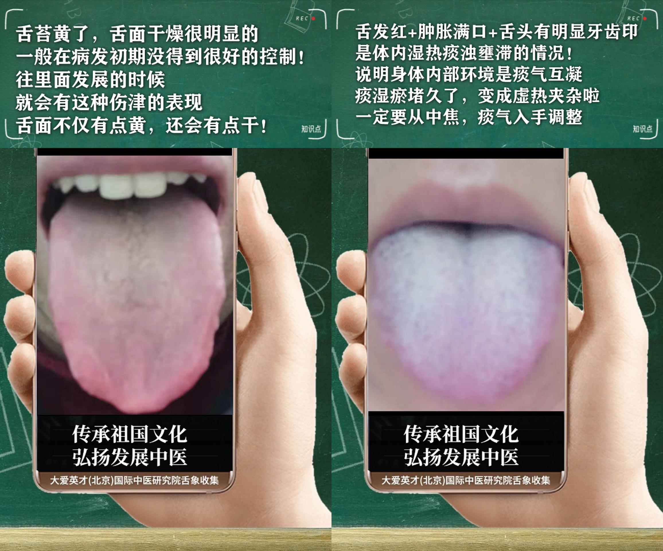 胃病|中医实解:满脸油腻,鼻炎,小便量少,手脚发冷