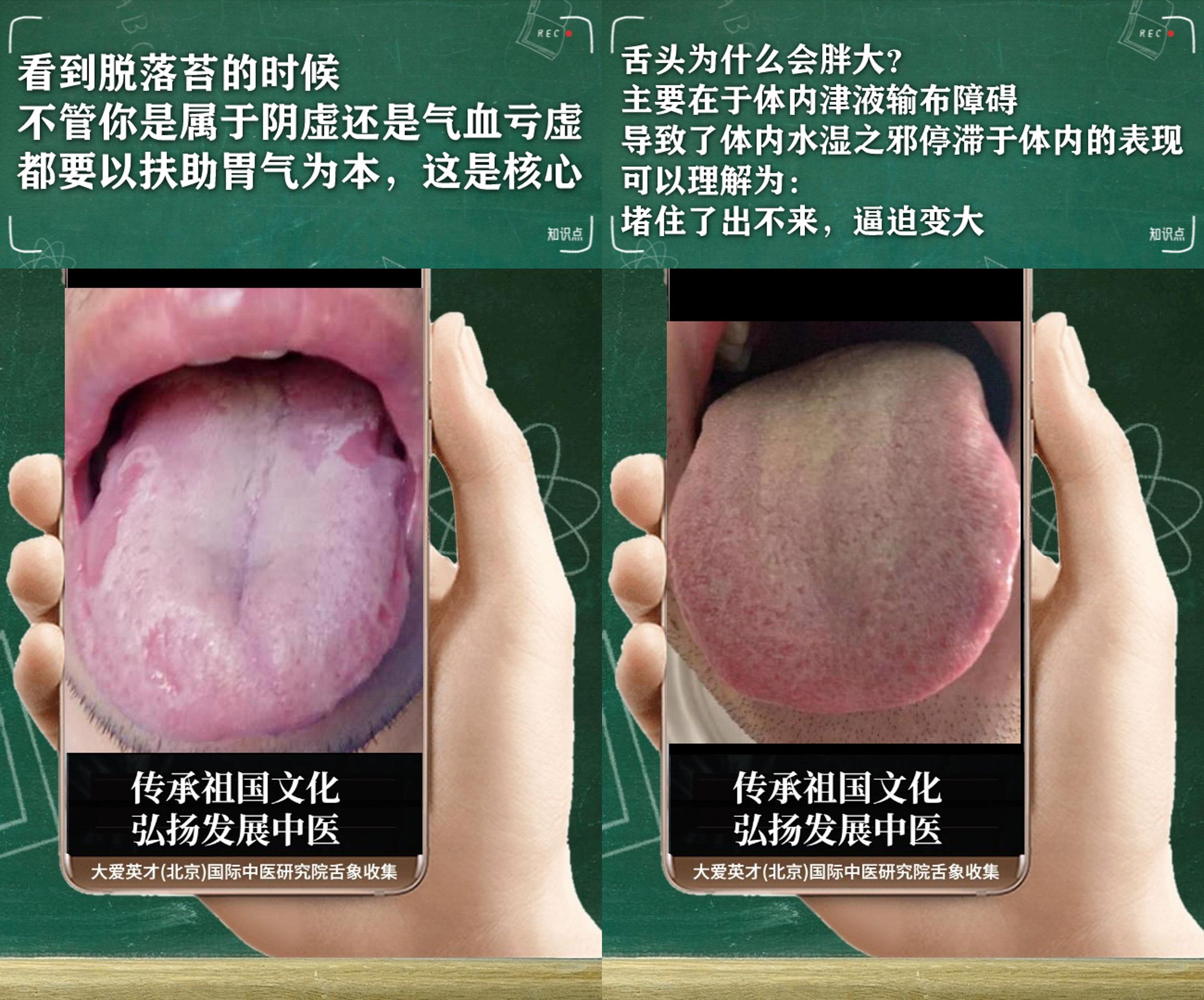 皮肤病|中医解析：工作效率低下，经常咳嗽，口苦，脾虚肾弱