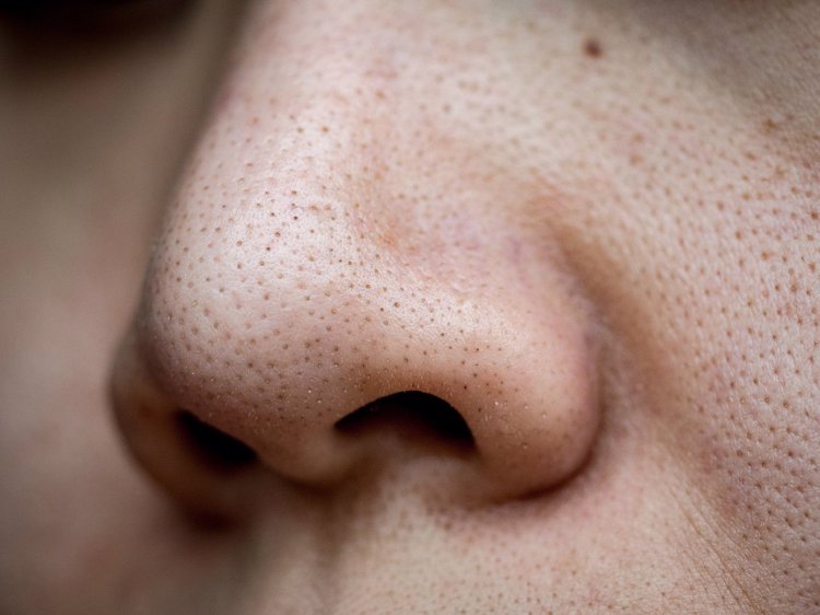痘痘|每个爱挖鼻孔的人，或早或迟可能要承受4个后果，劝你手下留情