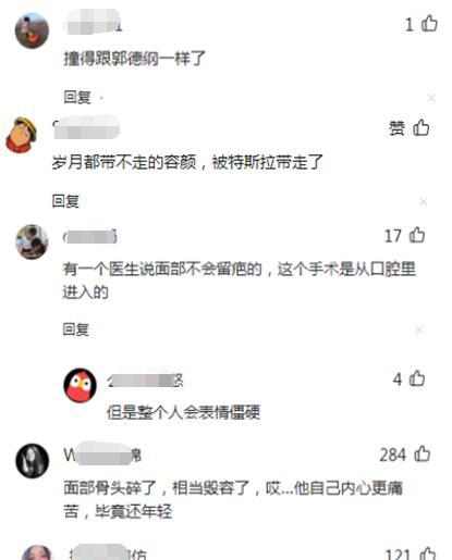 林志颖|林志颖安全了！哥哥林志杰透露自己都没进去看他，容貌恢复成焦点