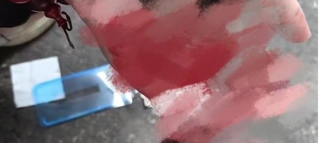西安男子被高楼坠落手机贴膜壳砸中,伸手一摸头竟满是鲜血