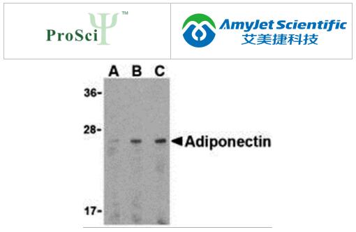 脂肪因子研究:ProSci脂联素和CTRPs 1-7检测套装