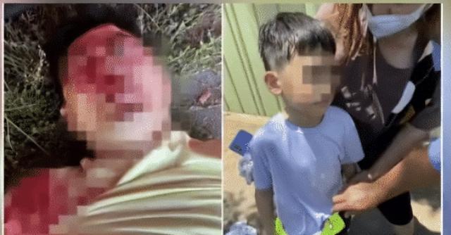 林志颖|这就是脸部3D重建?网友:看着都肉疼,林志颖得遭受多大的苦啊!