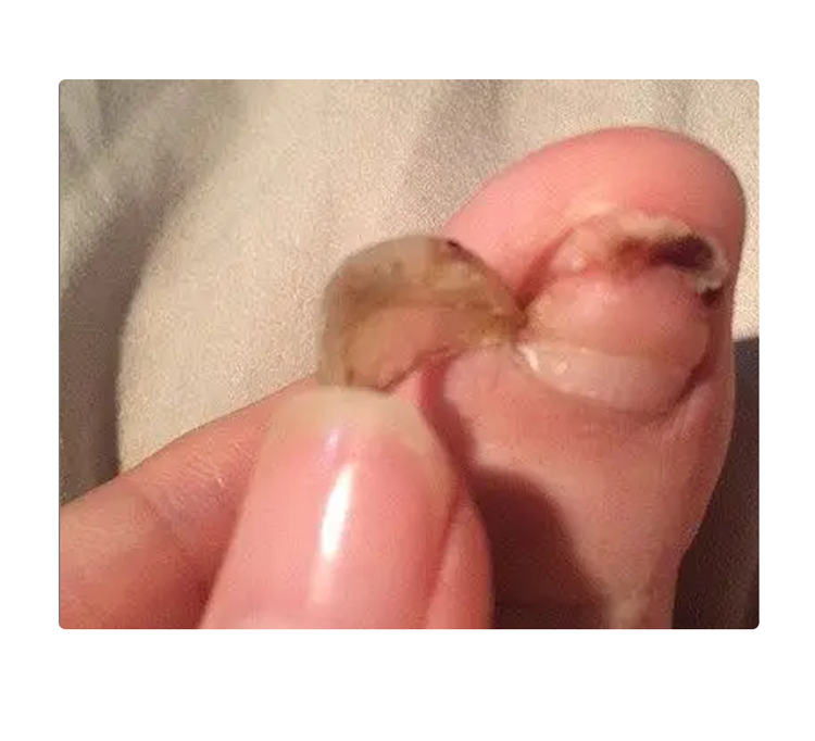 医生|我们常吃的麻辣鱼仔,是不是足疗店的退休小鱼?