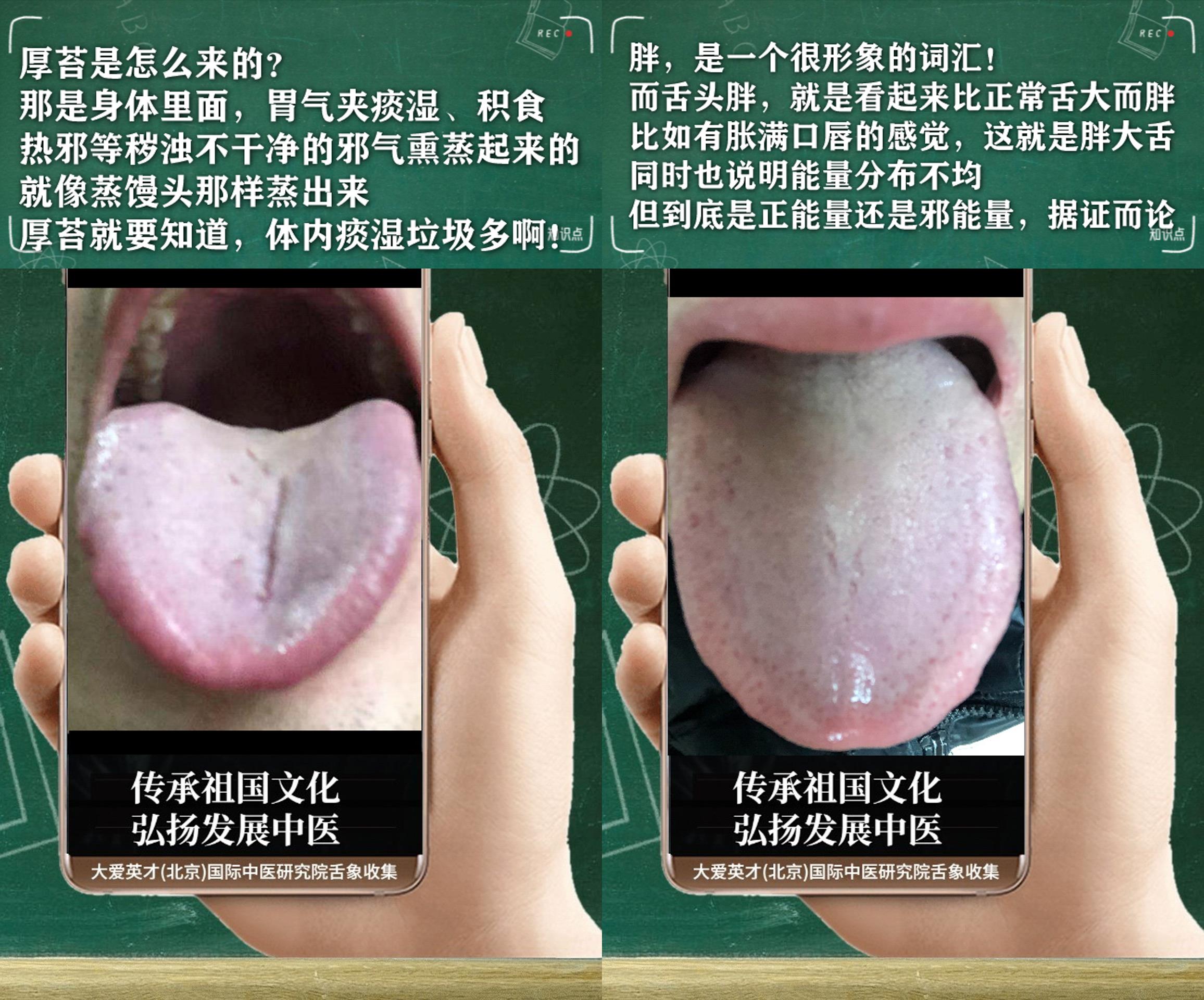 皮肤病|中医解析：工作效率低下，经常咳嗽，口苦，脾虚肾弱