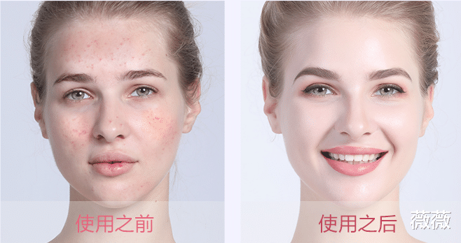 面膜 大牌护肤品被曝含致癌雌激素？网友：贫穷又一次救了我