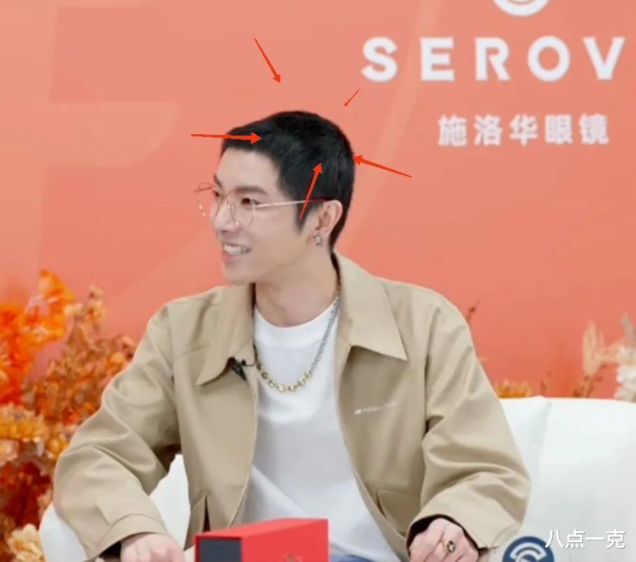 华晨宇|华晨宇寸头造型新鲜出炉,前后脑壳分层严重,难掩植发痕迹