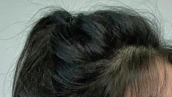 洗发水 头发越洗越差了？曝光洗发水“黑名单”：阿道夫脱毛膏，蜂花白月光