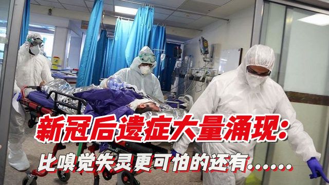 研究发现,大多数长期 COVID 影响在感染后一年内消退
