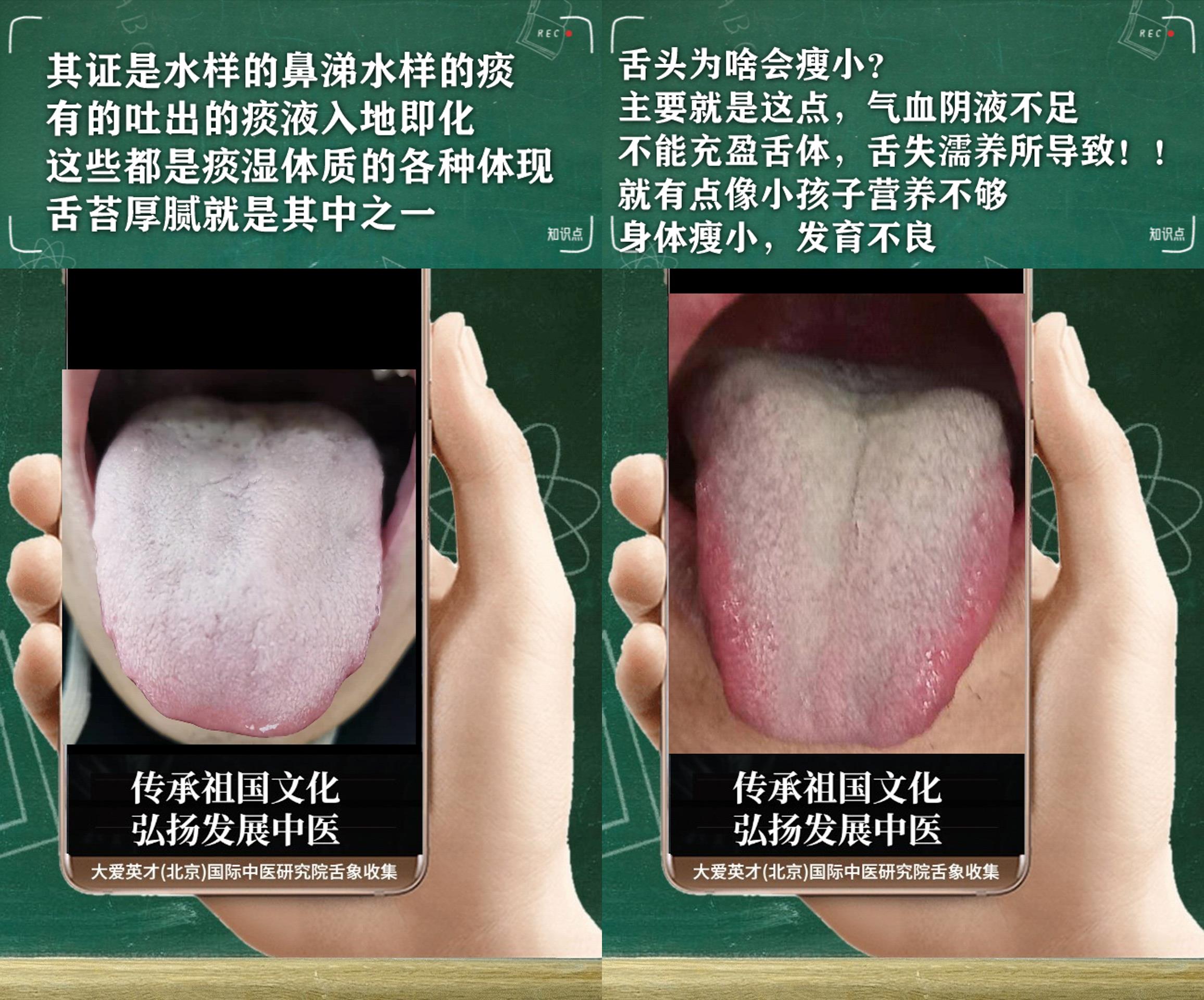 咳嗽|中医分析:易愁苦,手足心热,咳嗽重,吐黏痰,经常复发很绝望