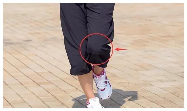 杨超越|杨超越红毯秀长腿身材火辣，膝盖内侧鼓包腿不直？5步轻松练