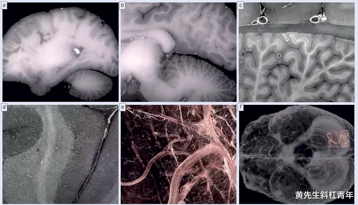 Google|谷歌地球、谷歌地图和谷歌天空之后,也许有一天我们会有一个谷歌身体搜索的工具!
