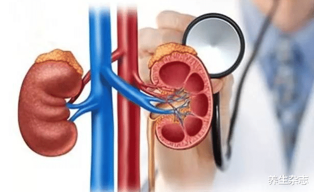 痛风|痛风多是\吃\出来的,医生警示:3种食物是尿酸催化剂,快扔掉