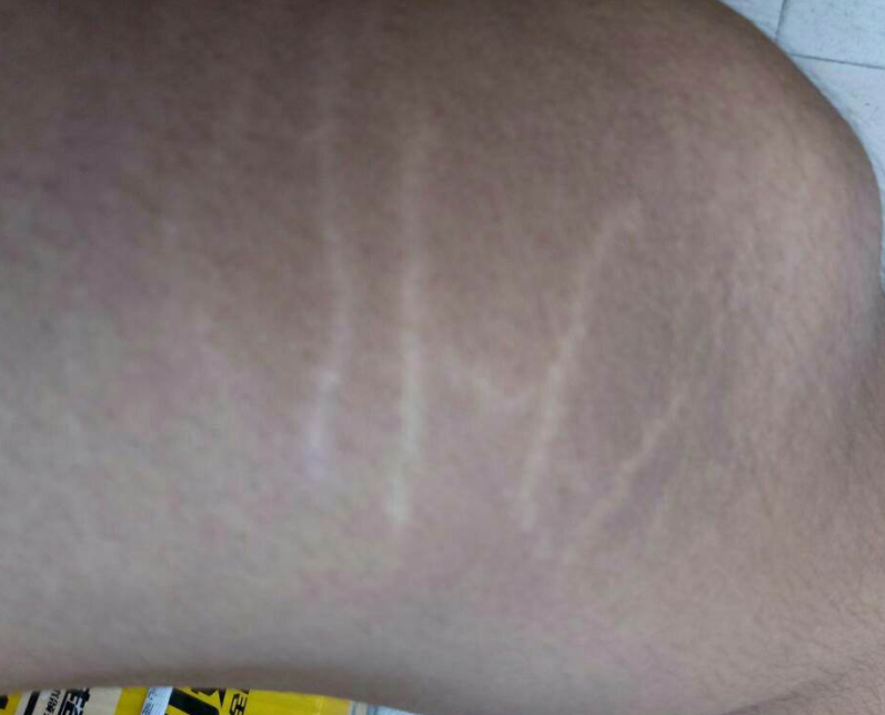 产妇 产妇产后超重减掉一个自己，结果面临更大尴尬，很多人都忽视这点