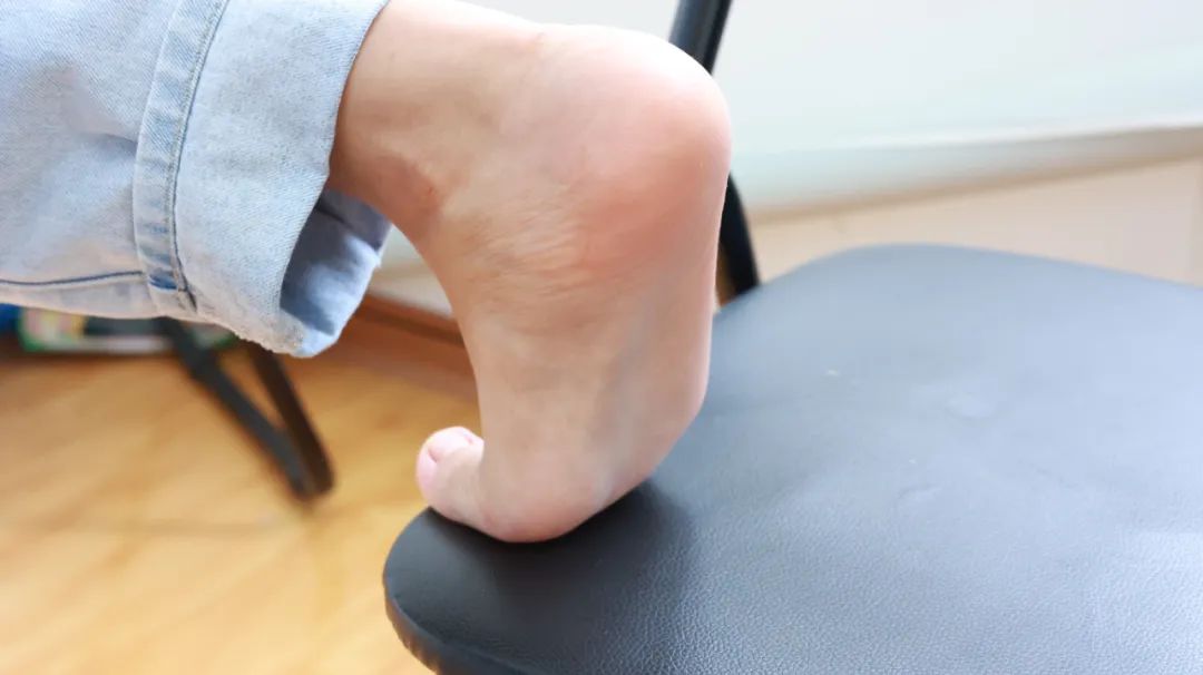 运动|这3种现象才是导致脚部开裂的原因，记得对症下药，才能拔除病源