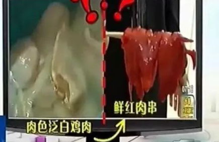 中药|女子体内取出468颗结石:惜命的最好方式不是养生,而是好好吃饭