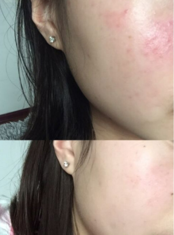 雅诗兰黛 公认好用5款零差评孕妇水乳,雅诗兰黛干皮救星、娇韵诗去黄提亮