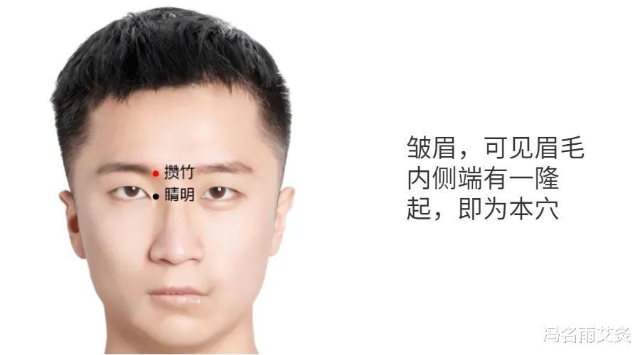 穴位|眼袋：用健脾祛湿穴位，解决眼袋和眼周松弛