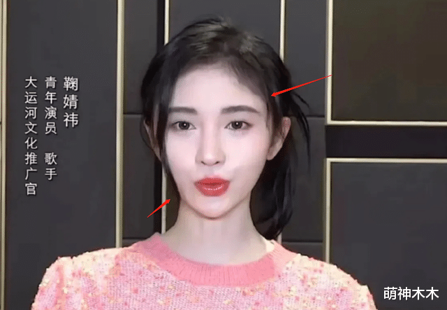 金晨|明星大型社死瞬间：金晨大笑眉心诡异凸起，杨紫剧中下巴压出坑