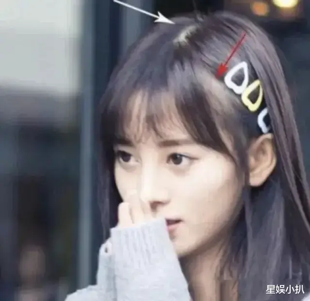 明星|肩膀打玻尿酸,腹肌靠手术,屁股靠垫,明星身上还有啥是真的?