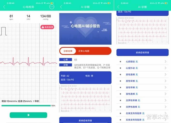 数据库|心脏不好的用户不可错过 dido E10S PRO智能手表
