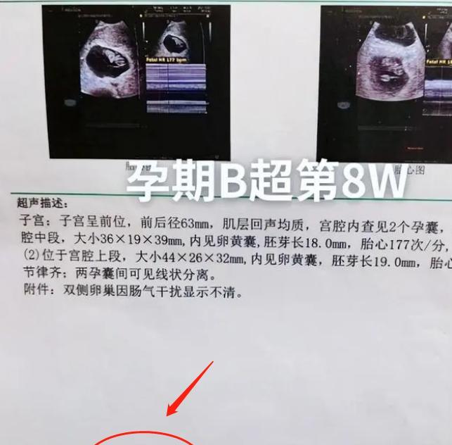 陈萌|朱小伟喜当爹？结婚半月陈萌犯困、想吐，大衣嫂抱胖娃练习带孙子