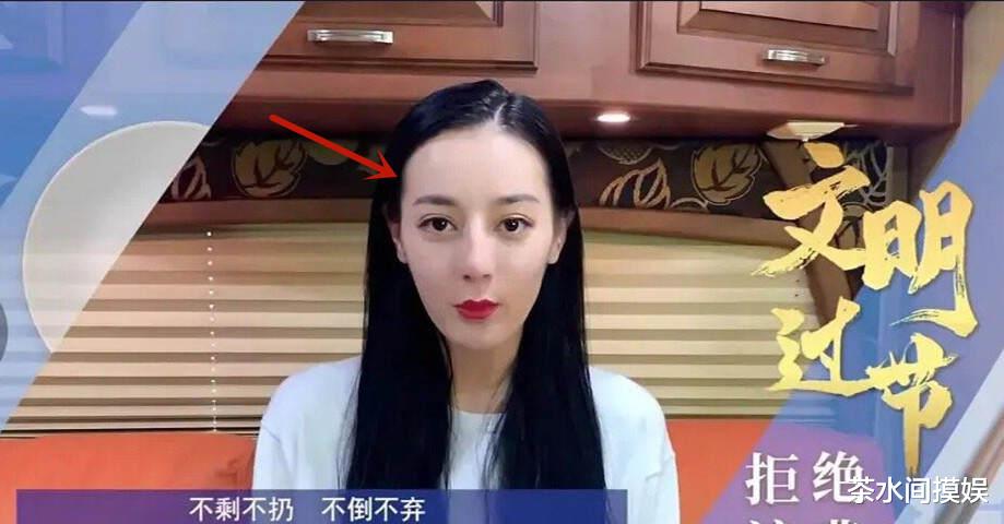 辣妹|女明星也有秃头危机？有人发际线堪比清朝阿哥，有人走路掉假发片