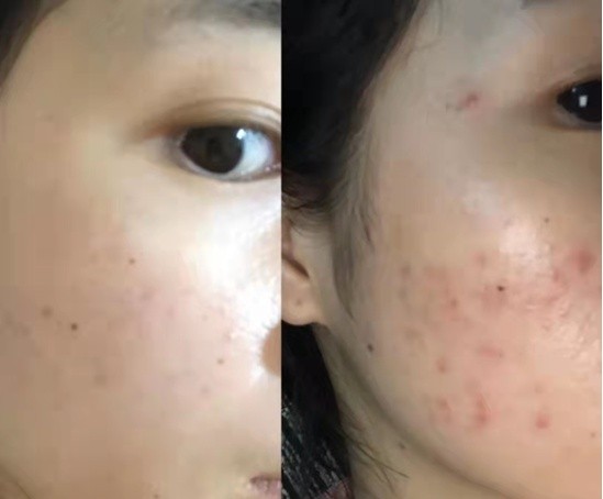 孕妈必看！孕期护肤品禁用成分黑名单曝光，快来看看你踩雷了吗？