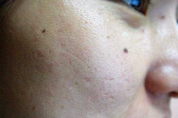 疾病|癌症来临之前,身体是有可能会出现8个现象的,须加倍小心