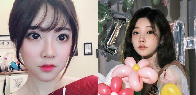 冯提莫|冯提莫被质疑秘密整容：暴瘦脸僵嘴合不起来