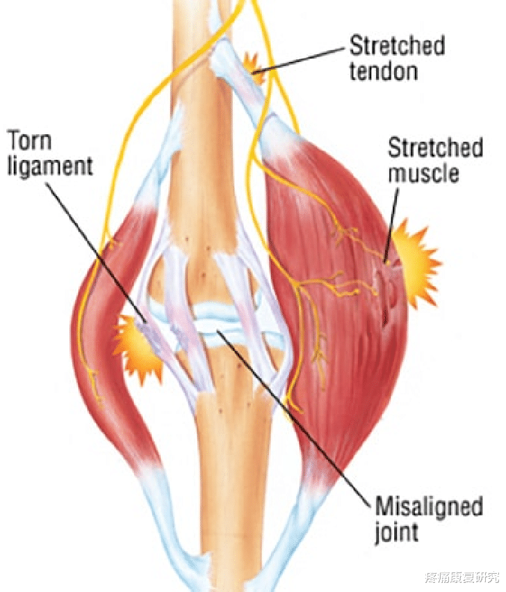 运动|肌肉失衡模式的经典动作评估与分析