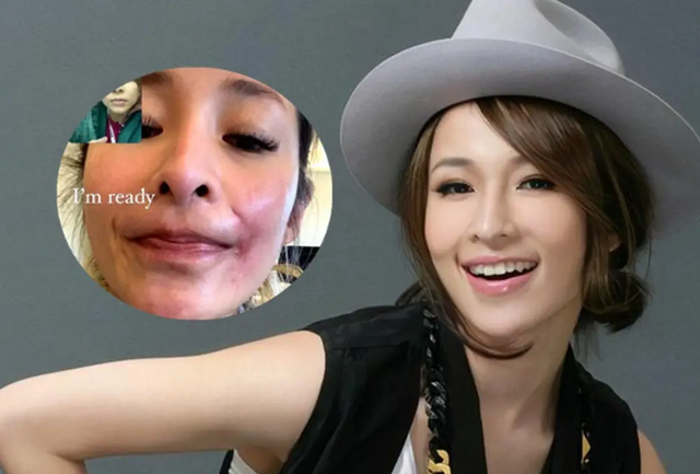 暮色心约|萧亚轩被狗咬后“消失”一年，近日首次直播，状态不佳女神范全无