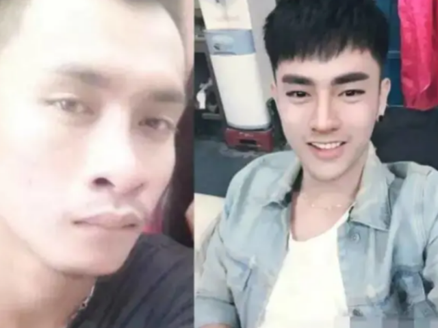 整容|长得丑讨不到老婆，小伙拿6万整容30次逆袭成帅哥，网友：帅呆了