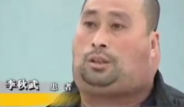东北男子嗜酒如命,20年喝下30000斤酒引发怪病,医生:治不了