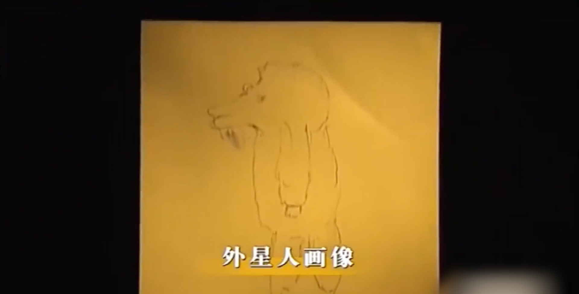 男子自称遭外星人解剖,身体里被植入芯片,谁料CT检查后令人惊奇