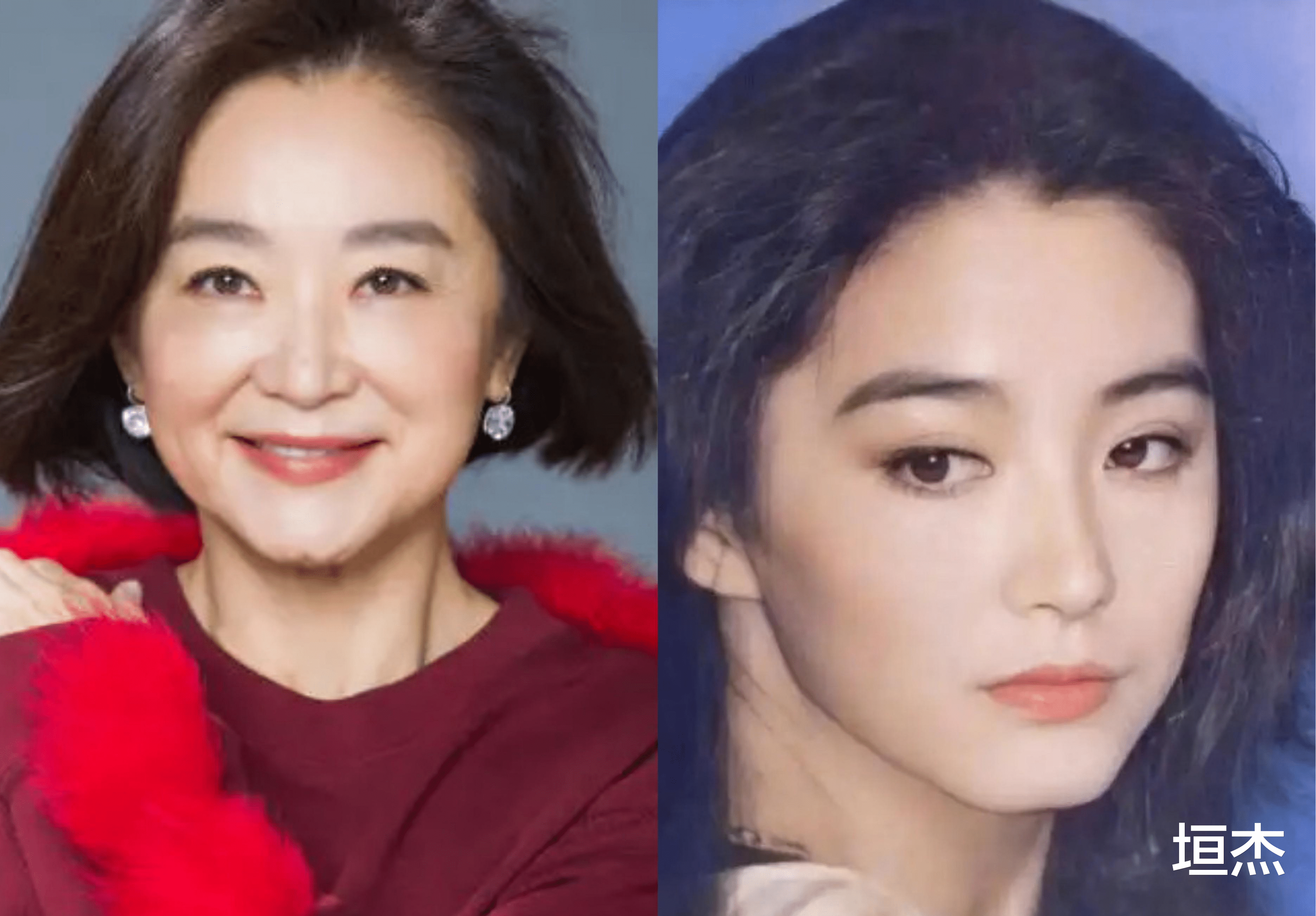 医美|一脸科技感、鼻子一捏就塌,“过度医美”的女星们,各有各的心酸