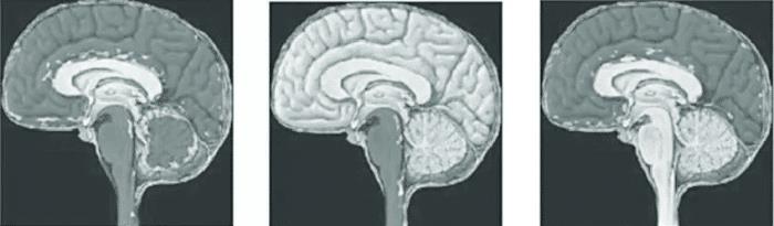 为防止假死后被活埋，他们在肛门放水蛭，用乳头夹钳