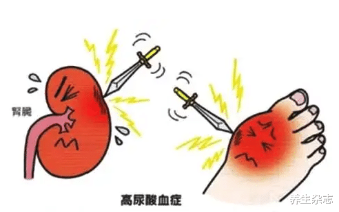 养生|再三提醒:不论男女,晨起出现4种异常,多半是肾衰,尽早就医