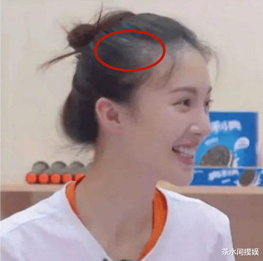 辣妹|女明星也有秃头危机？有人发际线堪比清朝阿哥，有人走路掉假发片