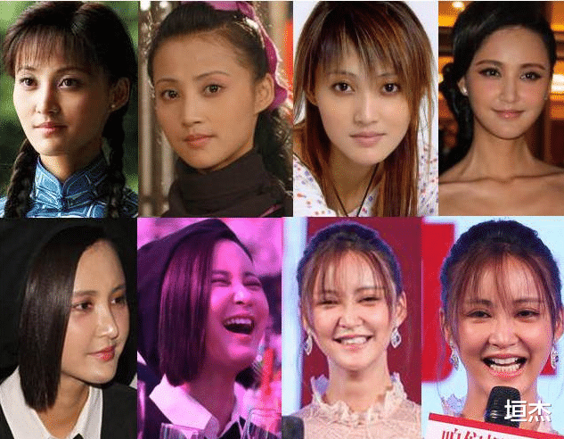 整容|满脸僵硬、肿成馒头，明明颜值拉胯，就别硬装“美少女”了