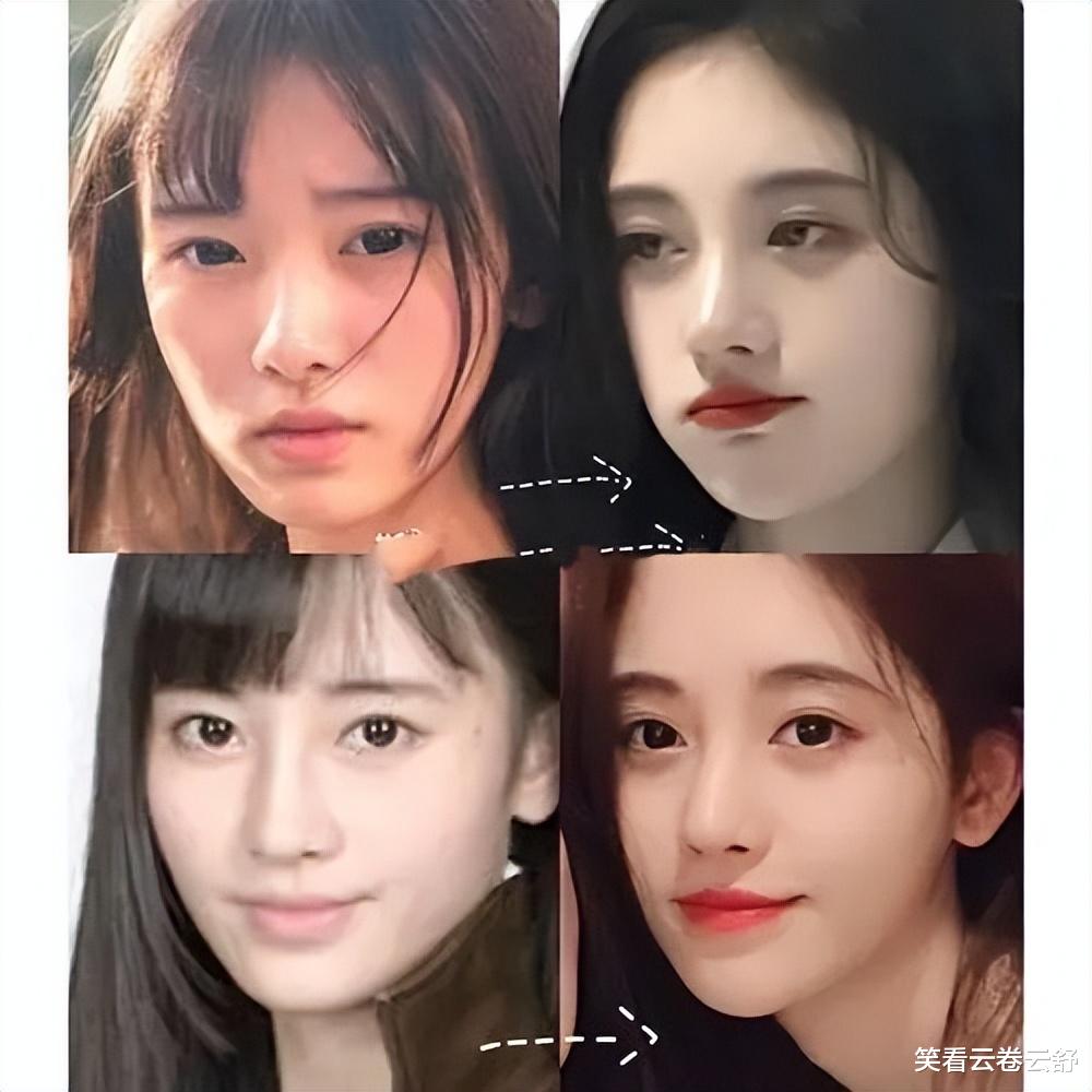 整容|有种倔强叫“我没整容”！明明从大饼脸变成了V脸，当观众瞎吗？